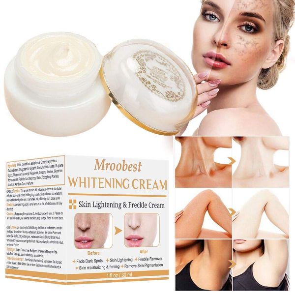Whitening Cream For Face Dark Spot Corrector Freckle Cream Brightening Cream Spot Cream For 